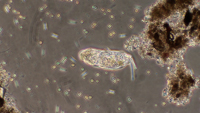 Rotifer 0035